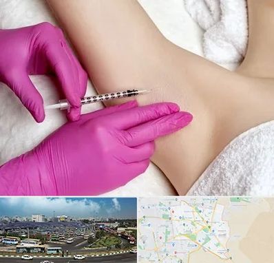 تزریق بوتاکس زیر بغل در منطقه 15 تهران 