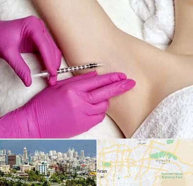 تزریق بوتاکس زیر بغل در شرق تهران 