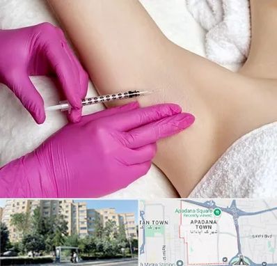 تزریق بوتاکس زیر بغل در آپادانا