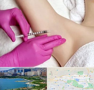 تزریق بوتاکس زیر بغل در منطقه 22 تهران 