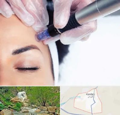 کلینیک مزوتراپی صورت در کردان