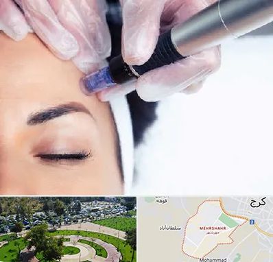 کلینیک مزوتراپی صورت در مهرشهر کرج 