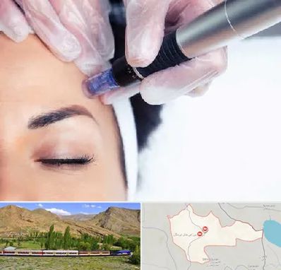 کلینیک مزوتراپی صورت در خاش