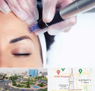 کلینیک مزوتراپی صورت در ونک 