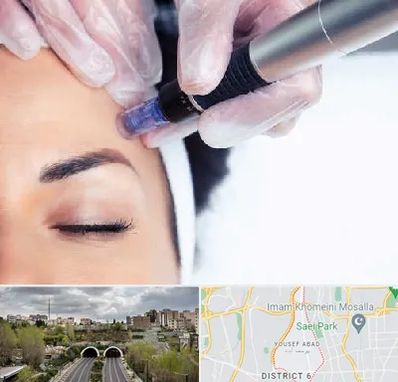 کلینیک مزوتراپی صورت در یوسف آباد 