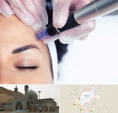 کلینیک مزوتراپی صورت در شهرضا