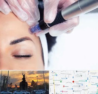 کلینیک مزوتراپی صورت در میدان حر 