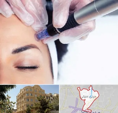 کلینیک مزوتراپی صورت در مینی سیتی