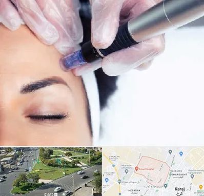 کلینیک مزوتراپی صورت در شاهین ویلا کرج