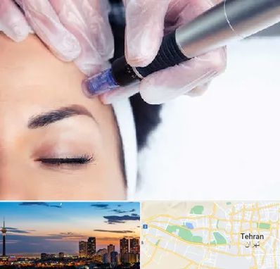 کلینیک مزوتراپی صورت در غرب تهران 