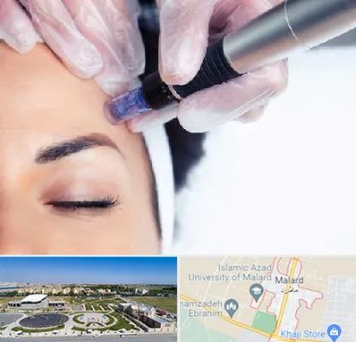 کلینیک مزوتراپی صورت در ملارد