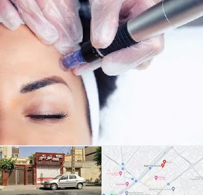 کلینیک مزوتراپی صورت در باجک قم