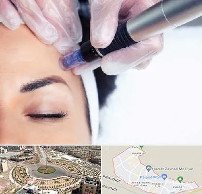 کلینیک مزوتراپی صورت در پرند