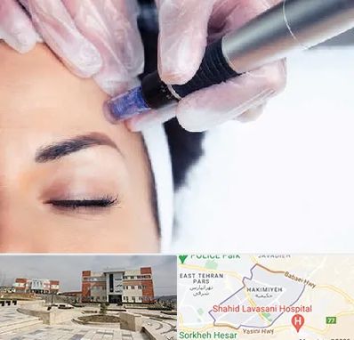 کلینیک مزوتراپی صورت در حکیمیه 