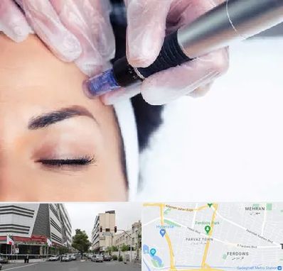 کلینیک مزوتراپی صورت در بلوار فردوس 