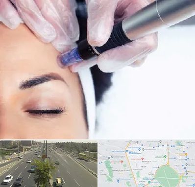 کلینیک مزوتراپی صورت در منطقه 17 تهران 