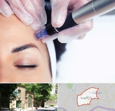 کلینیک مزوتراپی صورت در دزاشیب