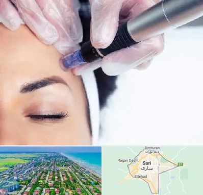 کلینیک مزوتراپی صورت در ساری