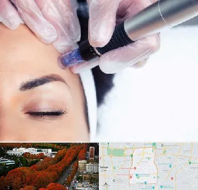 کلینیک مزوتراپی صورت در منطقه 6 تهران 