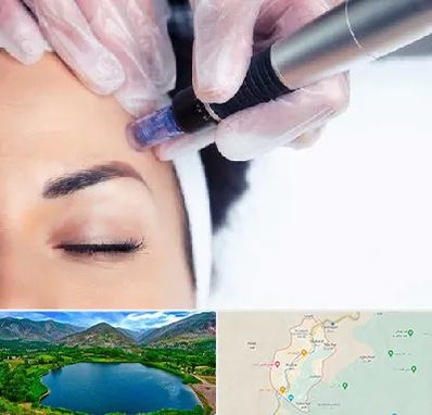 کلینیک مزوتراپی صورت در رودبار