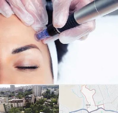 کلینیک مزوتراپی صورت در اوین