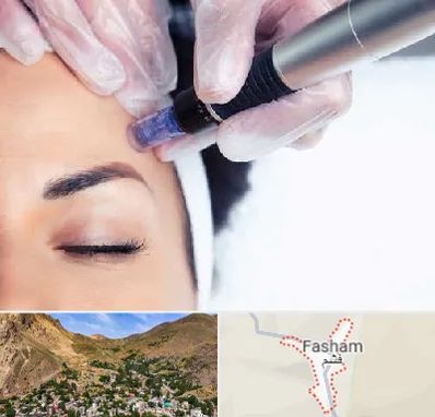 کلینیک مزوتراپی صورت در فشم