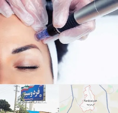 کلینیک مزوتراپی صورت در فردوسیه شهریار