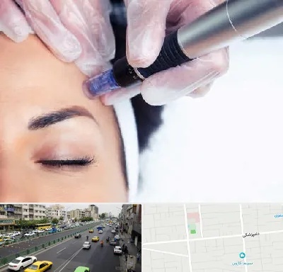 کلینیک مزوتراپی صورت در خیابان دامپزشکی