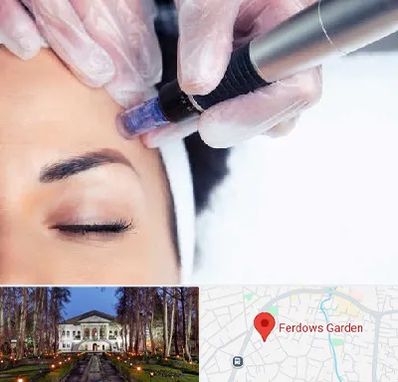 کلینیک مزوتراپی صورت در باغ فردوس