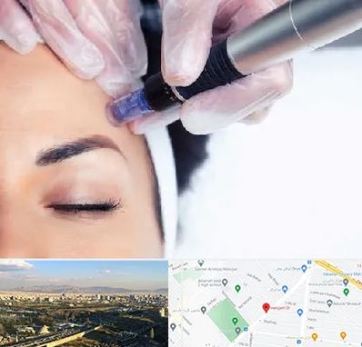 کلینیک مزوتراپی صورت در هنگام 