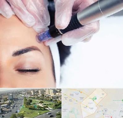 کلینیک مزوتراپی صورت در کمال شهر کرج