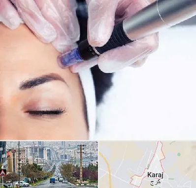 کلینیک مزوتراپی صورت در گوهردشت کرج 