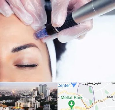 کلینیک مزوتراپی صورت در الهیه 