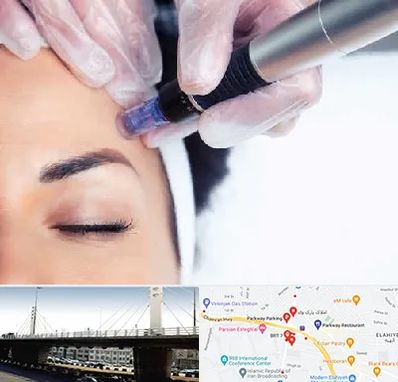 کلینیک مزوتراپی صورت در پارک وی 