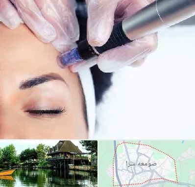 کلینیک مزوتراپی صورت در صومعه سرا