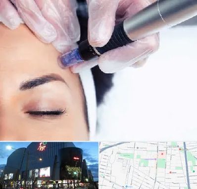 کلینیک مزوتراپی صورت در بلوار اباذر