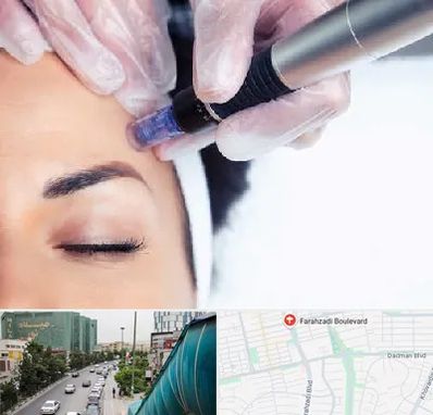 کلینیک مزوتراپی صورت در بلوار فرحزادی