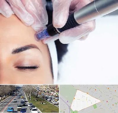 کلینیک مزوتراپی صورت در احمدآباد مشهد