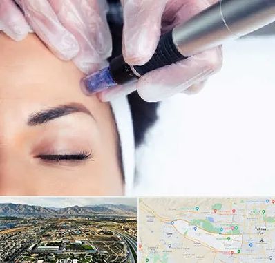 کلینیک مزوتراپی صورت در منطقه 21 تهران 