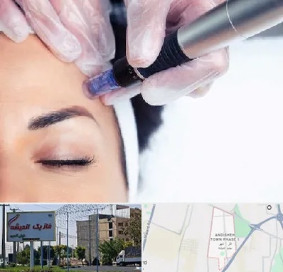 کلینیک مزوتراپی صورت در فاز یک اندیشه