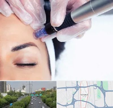 کلینیک مزوتراپی صورت در توانیر