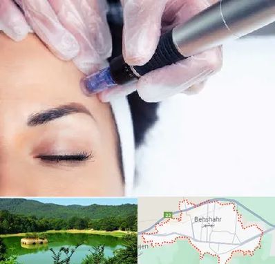 کلینیک مزوتراپی صورت در بهشهر