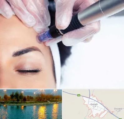 کلینیک مزوتراپی صورت در قروه