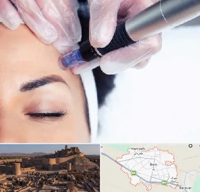 کلینیک مزوتراپی صورت در بم