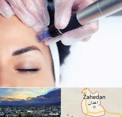 کلینیک مزوتراپی صورت در زاهدان