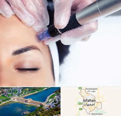 کلینیک مزوتراپی صورت در اصفهان