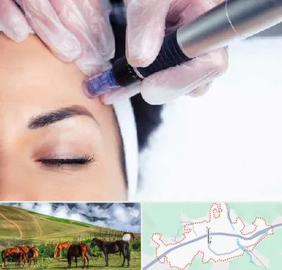 کلینیک مزوتراپی صورت در تالش