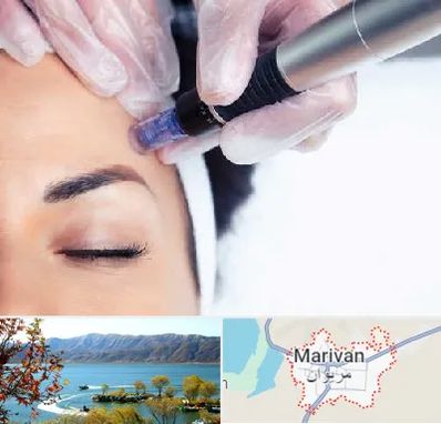 کلینیک مزوتراپی صورت در مریوان