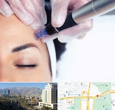 کلینیک مزوتراپی صورت در حقانی 