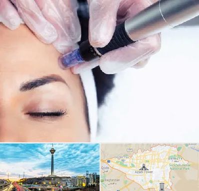 کلینیک مزوتراپی صورت در تهران